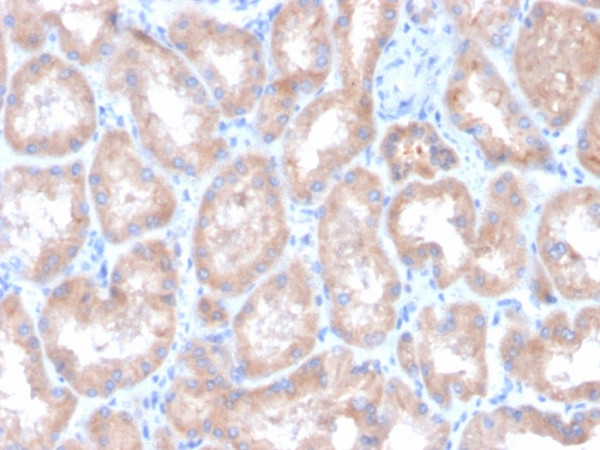 Anti-Renal Cell Carcinoma (Carbonic Anhydrase IX), clone CA9/3407