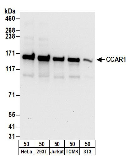Anti-CCAR1