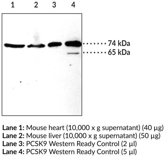 Anti-PCSK9