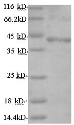 Follicle-stimulating hormone receptor (FSHR), partial, human, recombinant