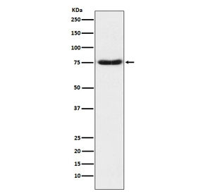Anti-Netrin 1 / NTN1, clone AFAD-14