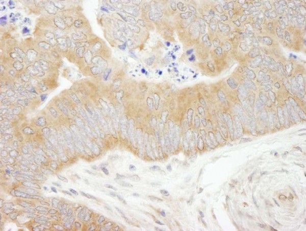 Anti-eIF2alpha/EIF2S1 (IHC)