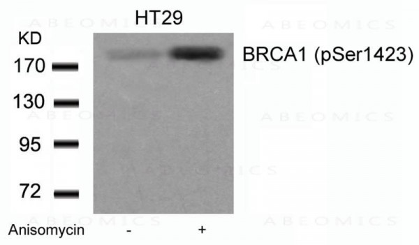 Anti-phospho-BRCA1 (Ser1423)