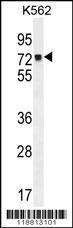 Anti-MLH1, ID (MLH1, COCA2, DNA mismatch repair protein Mlh1, MutL protein homolog 1)