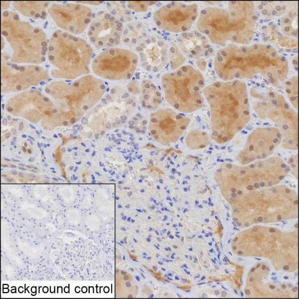 Anti-TMEM161B