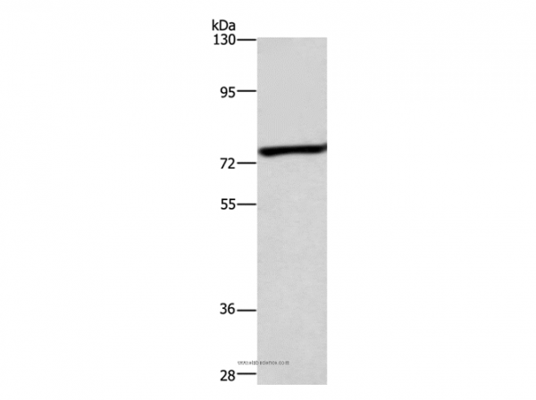 Anti-ABCB8