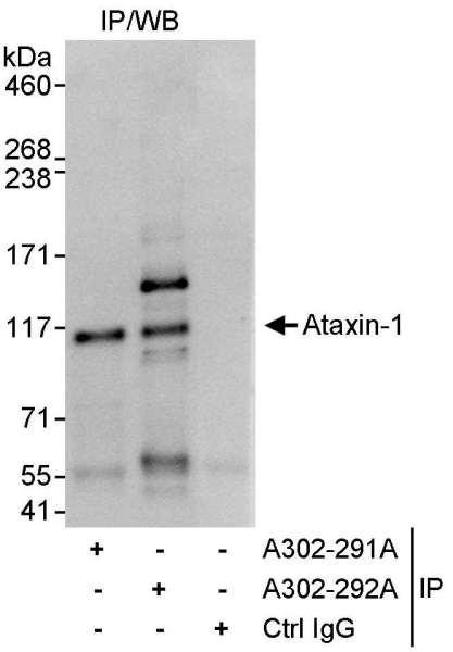 Anti-Ataxin-1