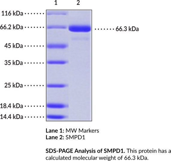 SMPD1 (human, recombinant)