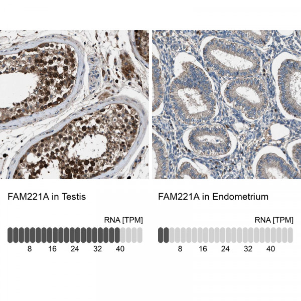 Anti-FAM221A