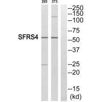Anti-SRSF4