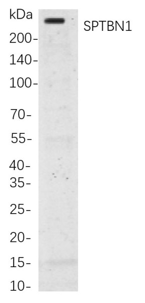 Anti-Recombinant SPTBN1, clone 4D11