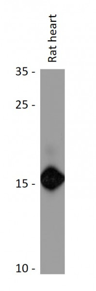 Anti-POLR2F