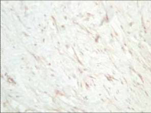 Anti-SFRP1