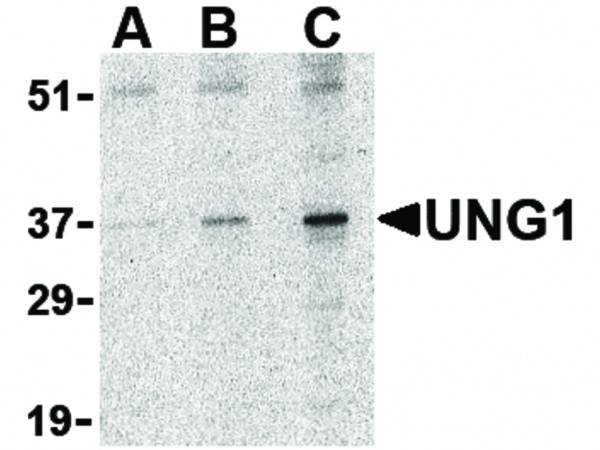 Anti-UNG1