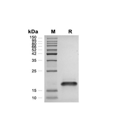 Exodus-2 Recombinant (Human)