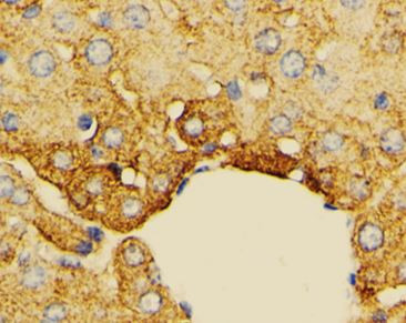 Anti-PFDN4
