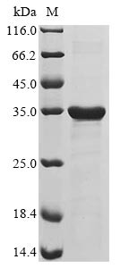 Achaete-scute homolog 1 (ASCL1), human, recombinant