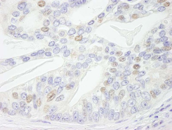 Anti-NBS1 IHC Antibody, affinity purifie (IHC)