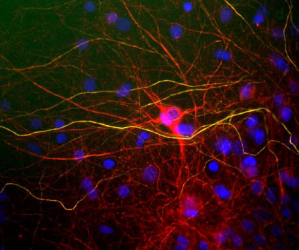 Anti-Neurofilament NF-H