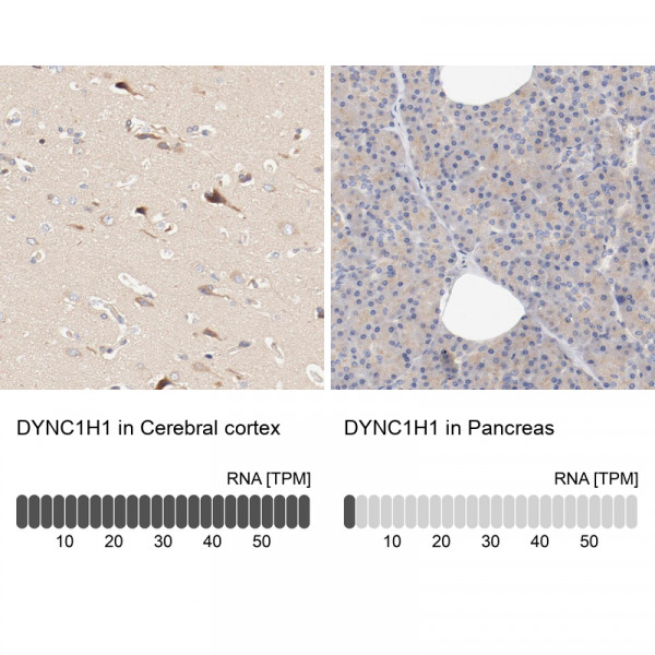 Anti-DYNC1H1