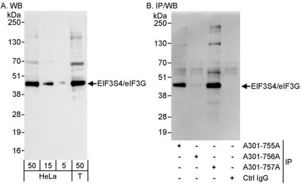 Anti-eIF3G/EIF3S4