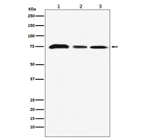 Anti-KAT7 / HBO1 / MYST2, clone ADAE-11