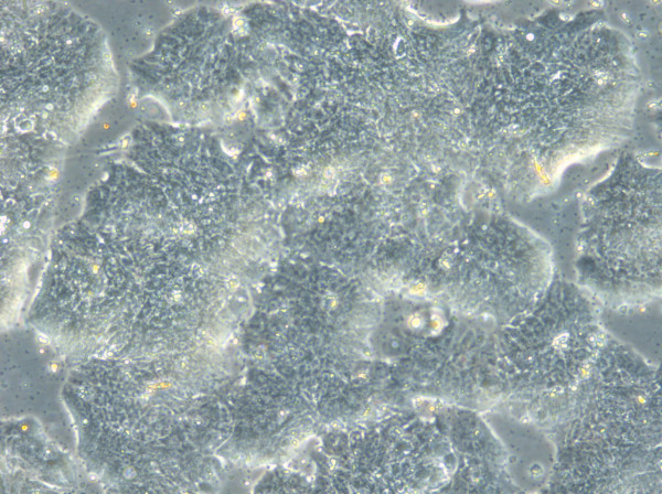 HROC113 Cells
