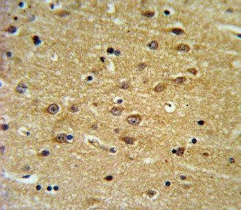 Anti-EHD3