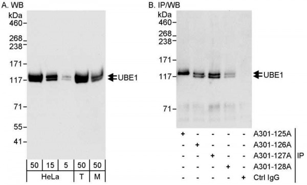 Anti-UBE1