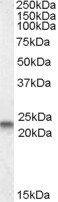Anti-caveolin 3, N-terminal