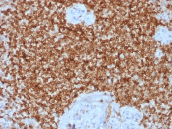 Anti-Bcl-2, clone BCL2/1878R