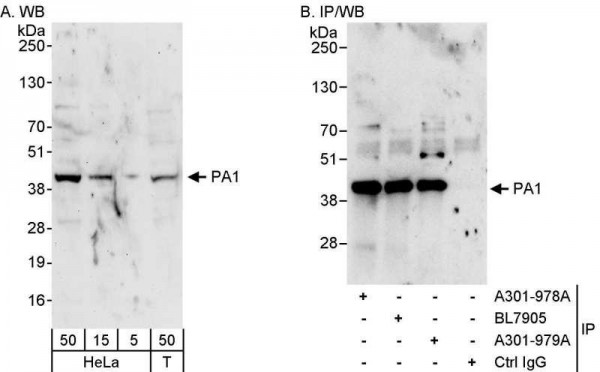 Anti-PA1