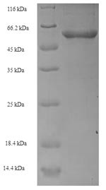 Transcobalamin-1 (TCN1), human, recombinant