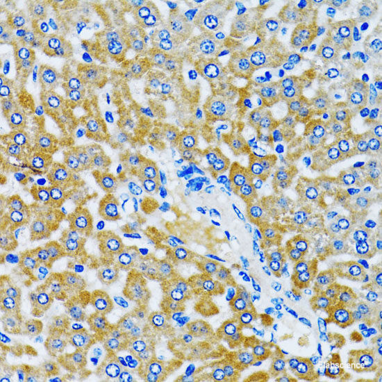 Anti-HDAC5