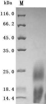 Lymphocyte antigen 6 complex locus protein G6d (LY6G6D) (Active), human, recombinant