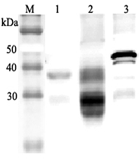Anti-Clusterin (mouse)