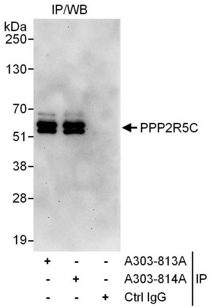 Anti-PPP2R5C