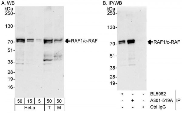 Anti-RAF1/c-RAF