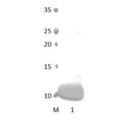 PDLIM2 PDZ Domain