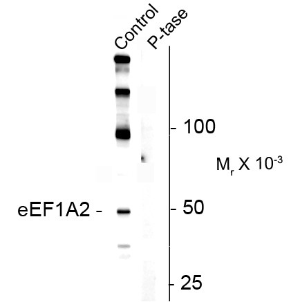 Anti-phospho-eEF1A2 (Ser358)