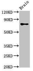 Anti-CASC1