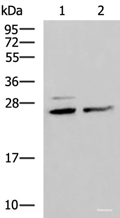 Anti-SNRPB2