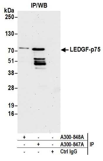 Anti-LEDGF/p75