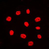 Anti-Estrogen Receptor alpha
