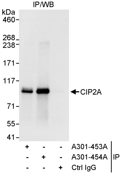 Anti-CIP2A