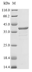 Myelin protein P0 (MPZ), partial, human, recombinant