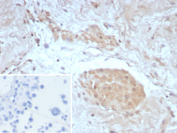 Anti-Survivin / BIRC5, recombinant antibody, clone BIRC5/8987R