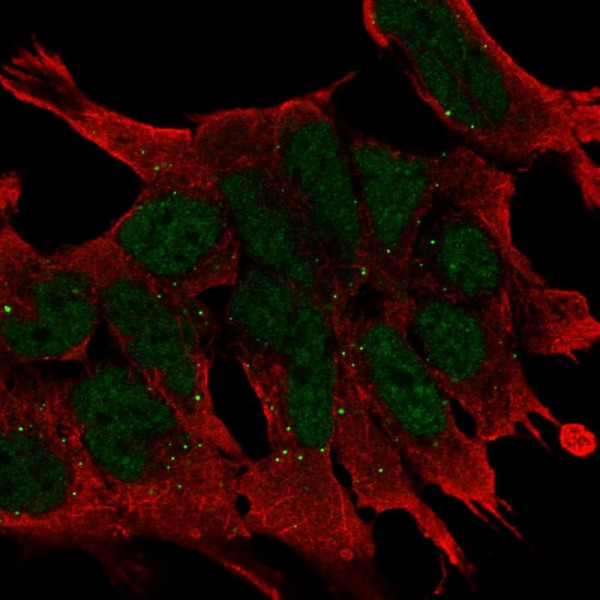 Anti-WNT2B