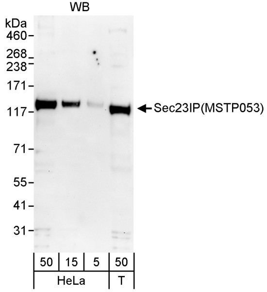 Anti-Sec23IP/MSTP053