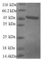 40S ribosomal protein S10 (RPS10), partial, human, recombinant